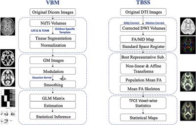 Brain structural alterations in young girls with Rett syndrome: A voxel-based morphometry and tract-based spatial statistics study